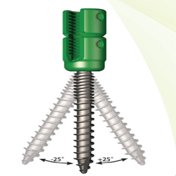 VIV6.0 Thoracolumbar posterior pedicle screw-rod internal fixation system - Image 2