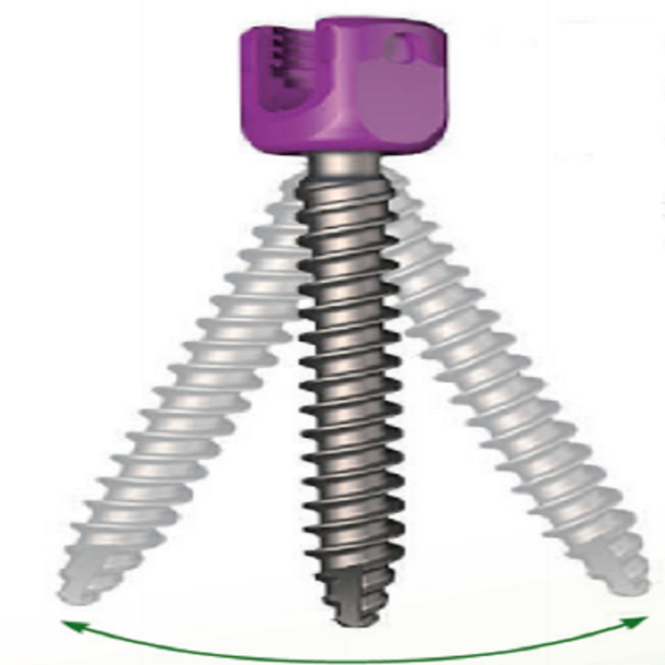 LEGERITY 5.5 Thoracolumbar Posterior Pedicle Screw-Rod Fixation System - Image 6