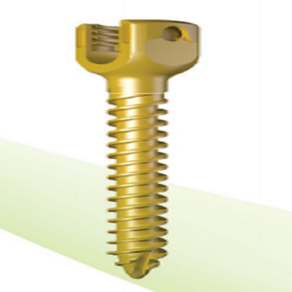 LEGERITY 5.5 Thoracolumbar Posterior Pedicle Screw-Rod Fixation System - Image 3