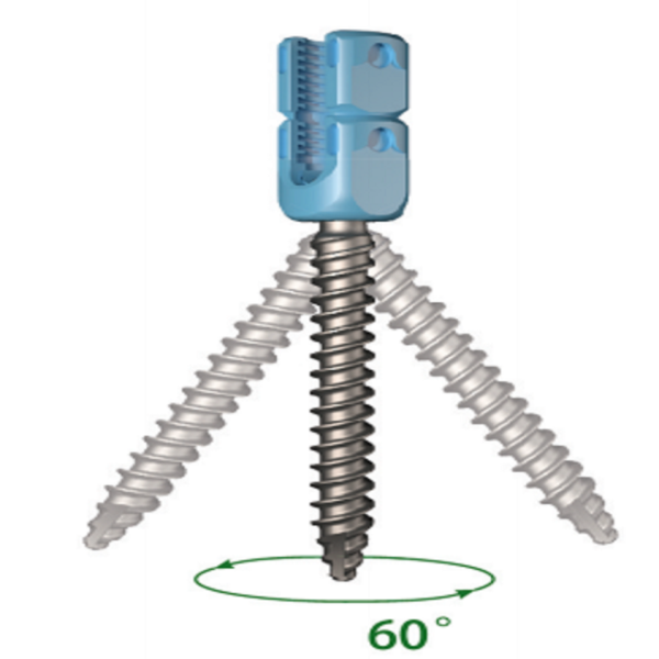 LEGERITY 5.5 Thoracolumbar Posterior Pedicle Screw-Rod Fixation System - Image 5
