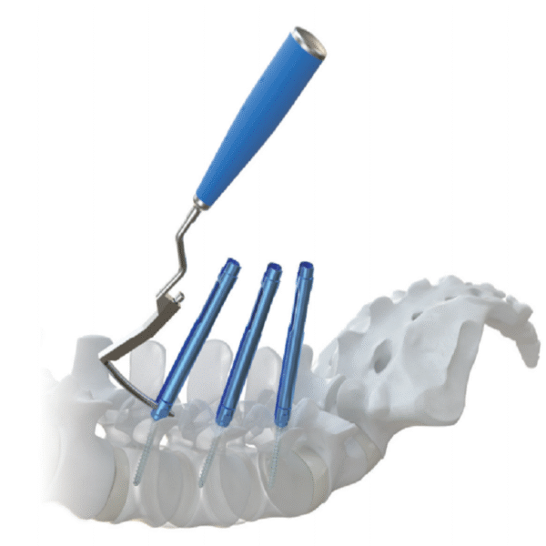 TINY 5.5 II Thoracolumbar posterior minimally - invasive screw - rod internal fixation system