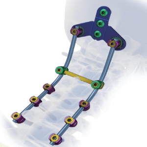 CREATION 3.5  Posterior Cervical Spinal Screw-Rod System